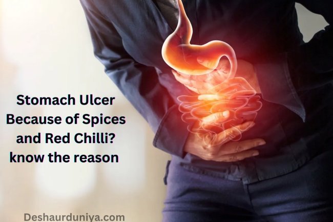 Stomach Ulcer Because of Spices and Red Chilli? know the reason
