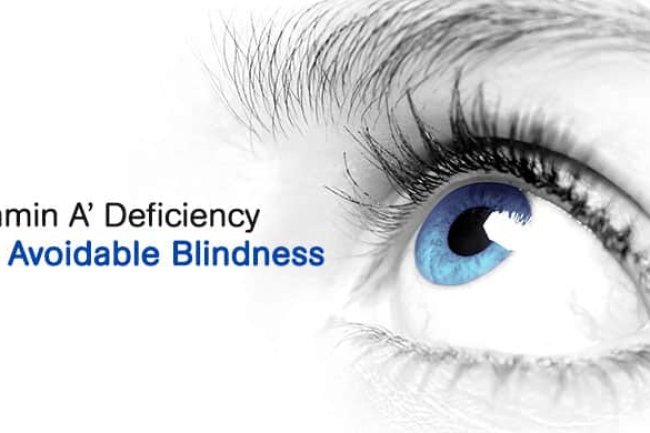 Vitamin A Deficiency: How It Impacts Eye Health