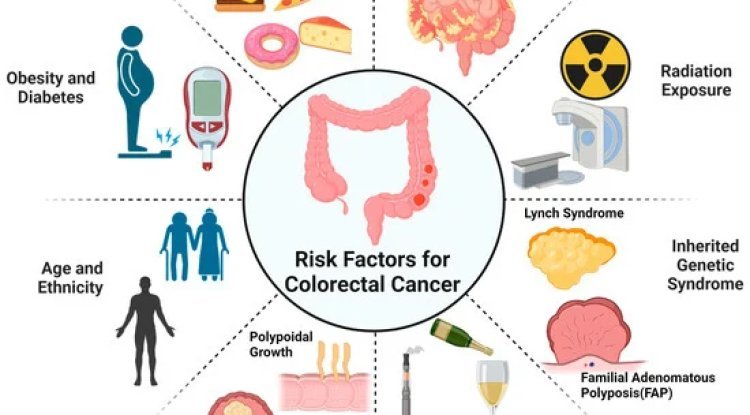 Late Eating Linked to Higher Risk for Colorectal Cancer
