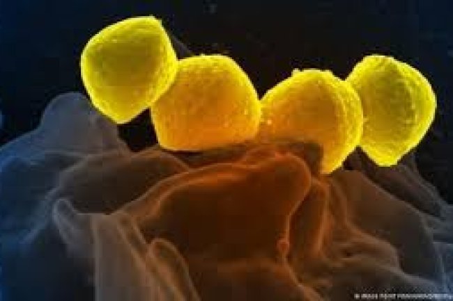 Infections with deadly flesh-eating bacteria are increasing in Japan