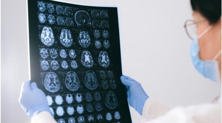 Novel Alzheimer's medication: US panel of experts approves Donanemab's FDA approval