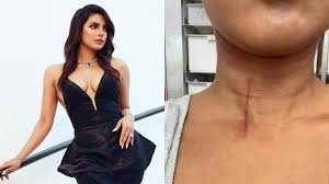 On the sets of "The Bluff," Priyanka Chopra was hurt; she claims it was a "professional hazard."